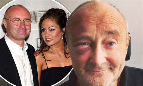 phil collins disease|phil collins wife murdered.